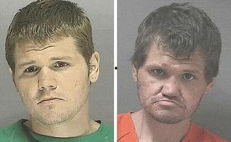 吸毒的人照片,毒品对身心健康的摧毁